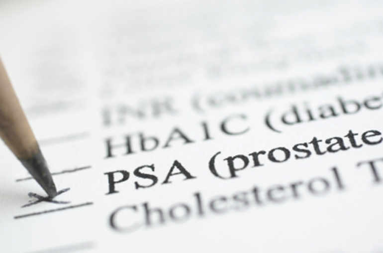 Cancer de la prostate et dosage du PSA: qui et à quel âge?
