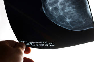 Une mammographie