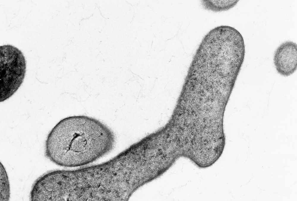 Bifidobacterium bifidum –Le probiotique «fourchu»