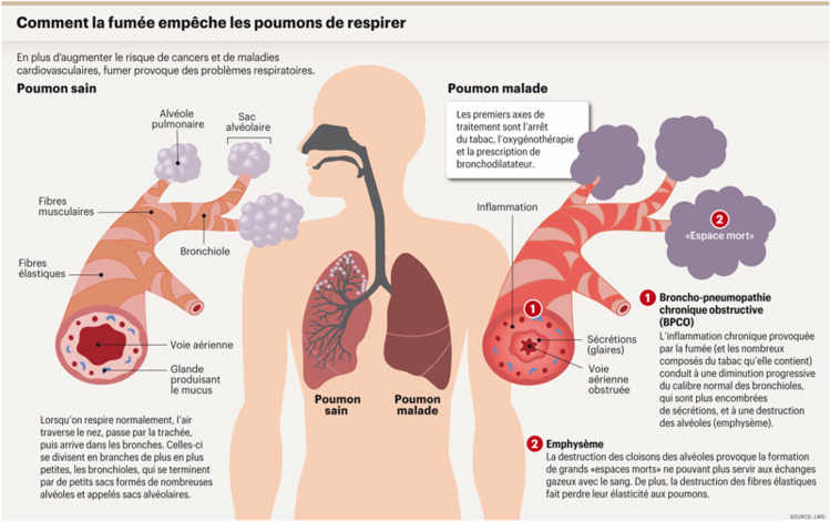 Comment la fumée empêche les poumons de respirer