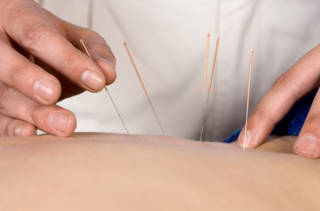 De l’acupuncture avant l’opération?