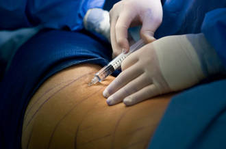 Chirurgie de l’obésité: quelle prise en charge par l’assurance de base?