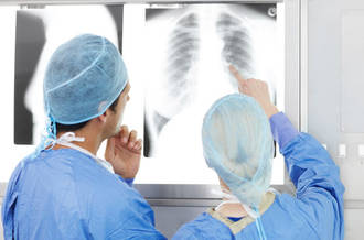 De tous les cancers, celui du poumon est le plus mortel