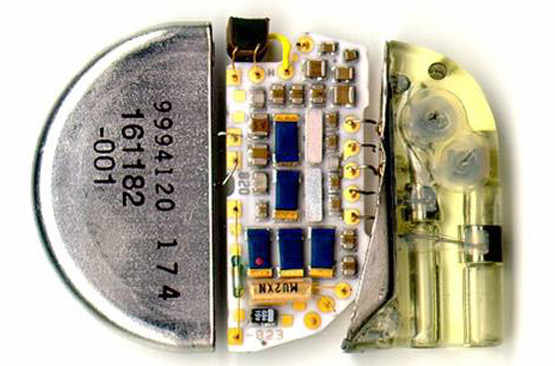 Le boîtier d'un pacemaker est composé d'une pile, d'un circuit imprimé et d'un connecteur.