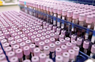 Laboratoire: la goutte de sang au cœur de la prise en charge hospitalière