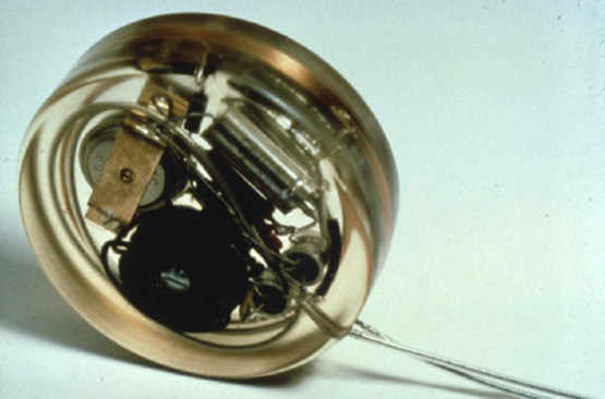 L'un des premiers pacemakers implantés