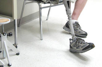 Prothèse de la jambe