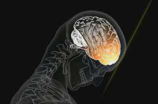 Traumatisme cranio-cérébral: des chocs pour les neurones