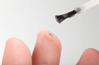 Les verrues en dix questions