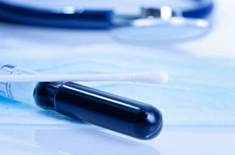 Vers un auto-dépistage à domicile du cancer du col de l’utérus