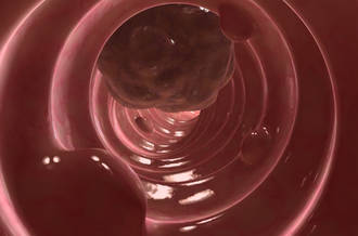 Les différentes méthodes de dépistage du cancer colorectal