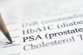 Cancer de la prostate et dosage du PSA: qui et à quel âge?