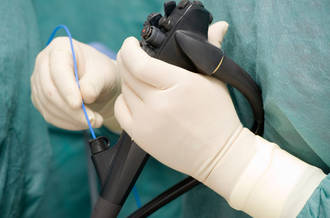 L’endoscopie pour traiter les cancers superficiels de l’estomac