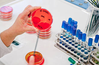 Immunothérapie anti-cancer: les promesses du parasite de la toxoplasmose