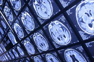 Pierre-Yves Dietrich « L’intensité des relations humaines m’a poussé vers l’oncologie »