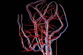 Les accidents vasculaires cérébraux frappent de plus en plus tôt