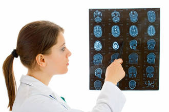 Commotion cérébrale: risque de mort prématurée multiplié par trois