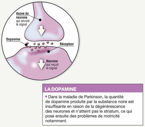 Infographie parkinson