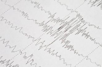 Manipulations cérébrales pour soigner les phobiques et les victimes de stress post-traumatiques