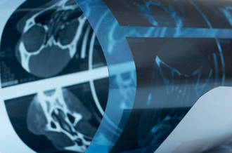 Prédire la récidive des crimes grâce à l’IRM