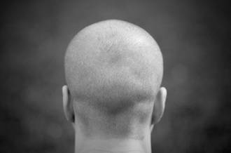 La stimulation cérébrale profonde, un espoir pour le traitement des addictions?