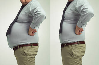 Les effets inattendus du by-pass gastrique