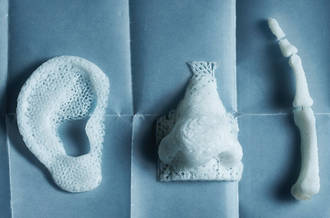 Impression 3D: quelles utilisations en médecine?
