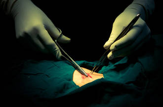 Des cicatrices de plus en plus petites