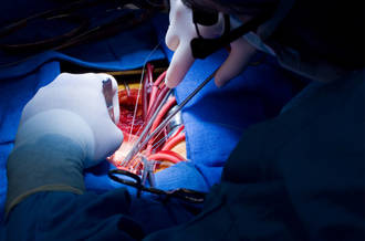 Un cœur artificiel high-tech bientôt testé sur l’homme