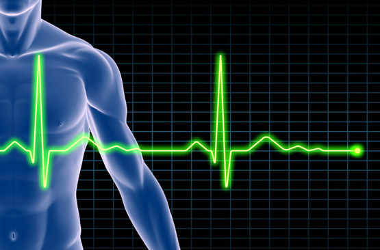 Silhouette d'homme et électrocardiogramme