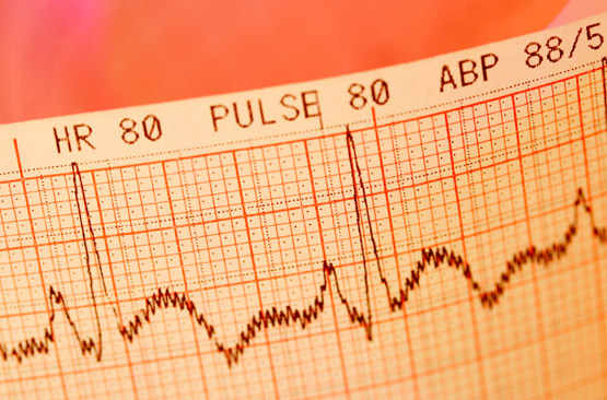 L’électrocardiogramme, pas encore recommandé en tant qu’outil de dépistage