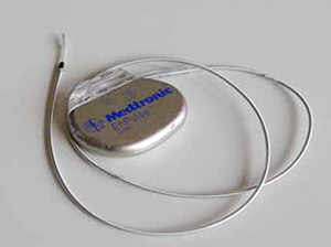 Un modèle de stimulateur cardiaque ou "pacemaker".