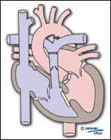 Image illustrant résultat après traitement chirurgical
