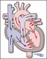 Schéma illustrant la physio-pathologie avec le sens du sang