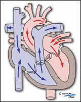Schéma illustrant la physio-pathologie de la coartation aortique   