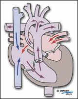 Schéma illustrant la physio-pathologie avec le sens du sang
