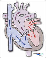 Schéma physio-pathologie tronc artériel