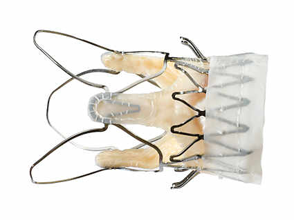 Photo d'une valve transapicale Sapien