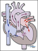 Schéma illustrant la physio-pathologie