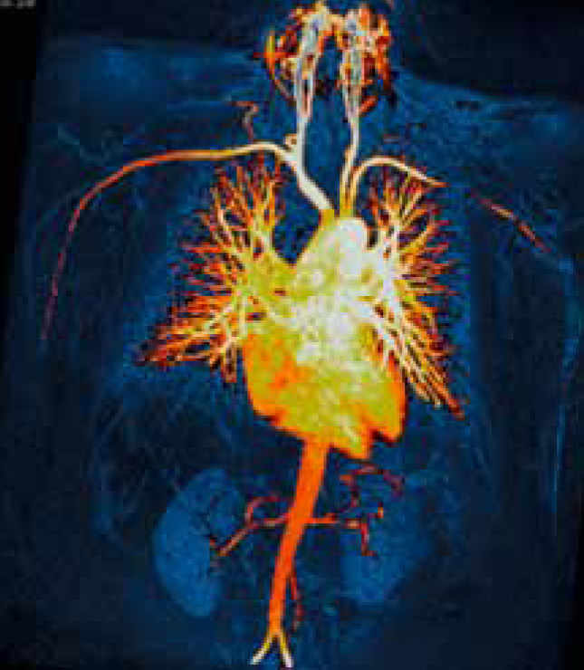Imagerie par résonance magnétique