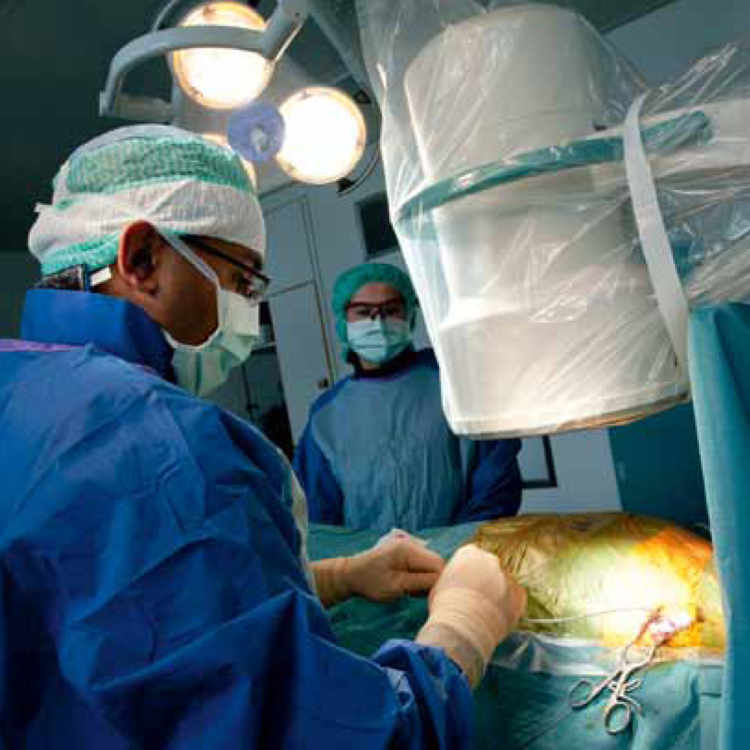 Pose d'un stimulateur