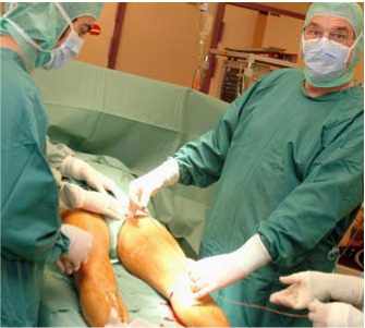 varice jambe operation