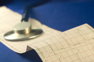 Infarctus et attaque cérébrale: les signes d’alarme