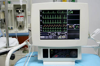 Les troubles du rythme cardiaque