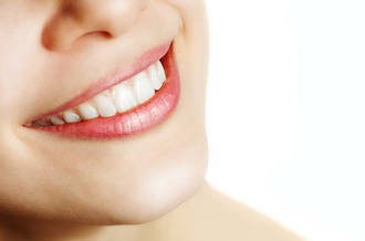 Un sourire éclatant exige patience et savoir-faire