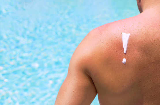 La crème solaire est insuffisante contre le cancer de la peau