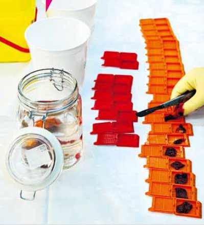 Des fragments d’organes sont prélevés, fixés en formol et envoyés au laboratoire d’histologie.