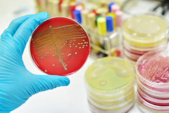 Atteint de septicémie, un patient sur huit décède des complications