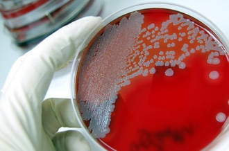 Les micro-organismes et nous: qui est en charge?