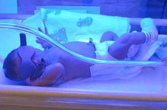 nouveau-né prématuré